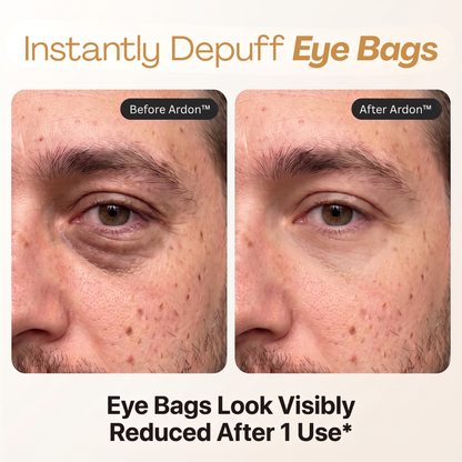 Ardon™ Instant Eye Firmer
