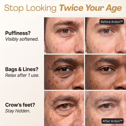 Ardon™ Instant Eye Firmer